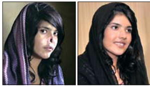 [뉴스 브리핑]코 잘린 아프간 여성, 수술로 회복 앞둬
